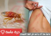 شركة مكافحة بق الفراش بخميس مشيط | 0593428144 | إبادة البق