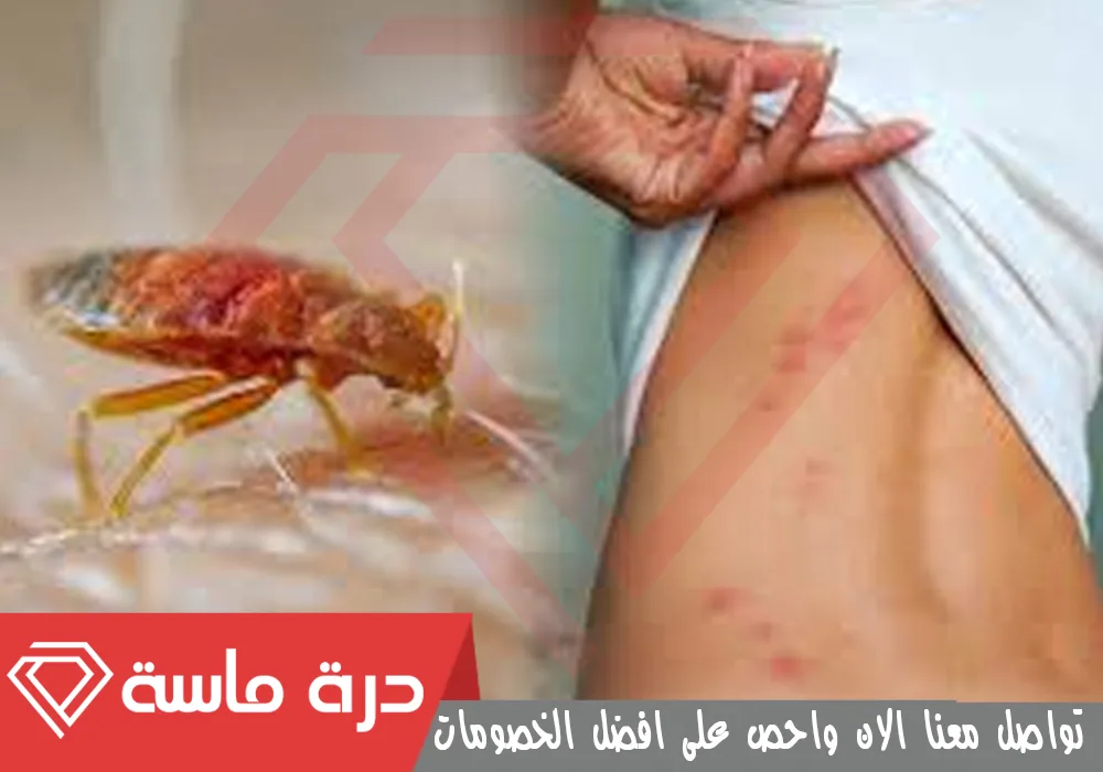 شركة مكافحة بق الفراش بخميس مشيط 🐞 | 0593428144 | إبادة البق 45 Bed bug control 2